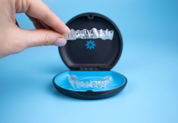 How Invisalign Aligner Replacement Frequency Influences Treatment Predictability and Clinical Success