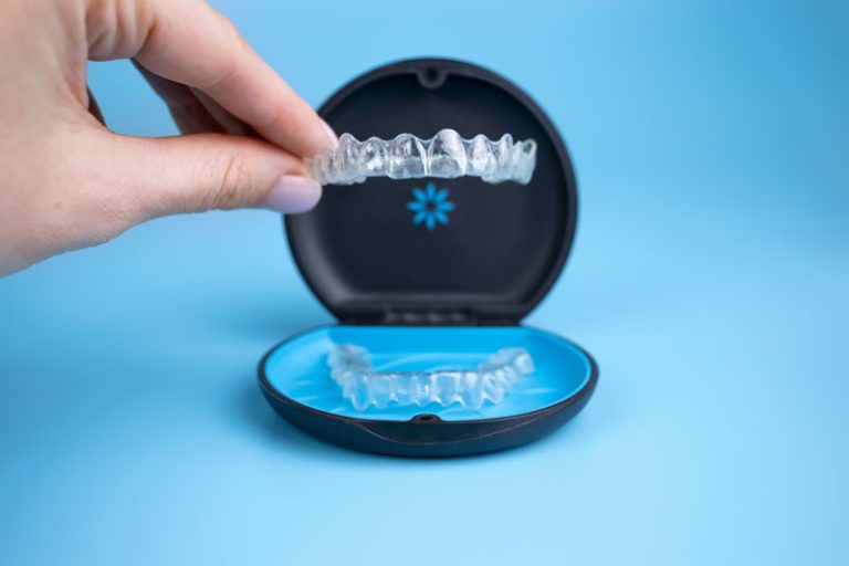 How Invisalign Aligner Replacement Frequency Influences Treatment Predictability and Clinical Success